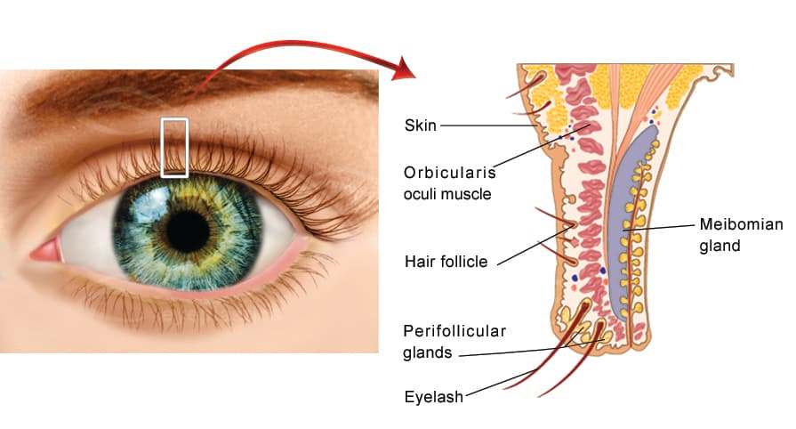 Eyelash follicle and meibomian gland anatomy where Demodex mites live